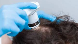 scalp-care scalp-care