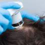Scalp Care - As tendências desse mercado promissor Scalp Care - As tendências desse mercado promissor