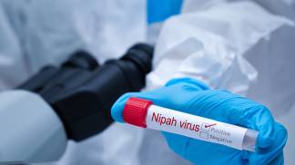 Fevereiro #3 - Vírus-Nipah-o-que-a-indústria-farmacêutica-precisa-entender-sobre-essa-ameaça-emergente.jpg