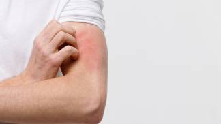 ABRIL 03 Alergia emocional o que a ciencia diz sobre a relacao entre emocoes e a pele (1).jpg